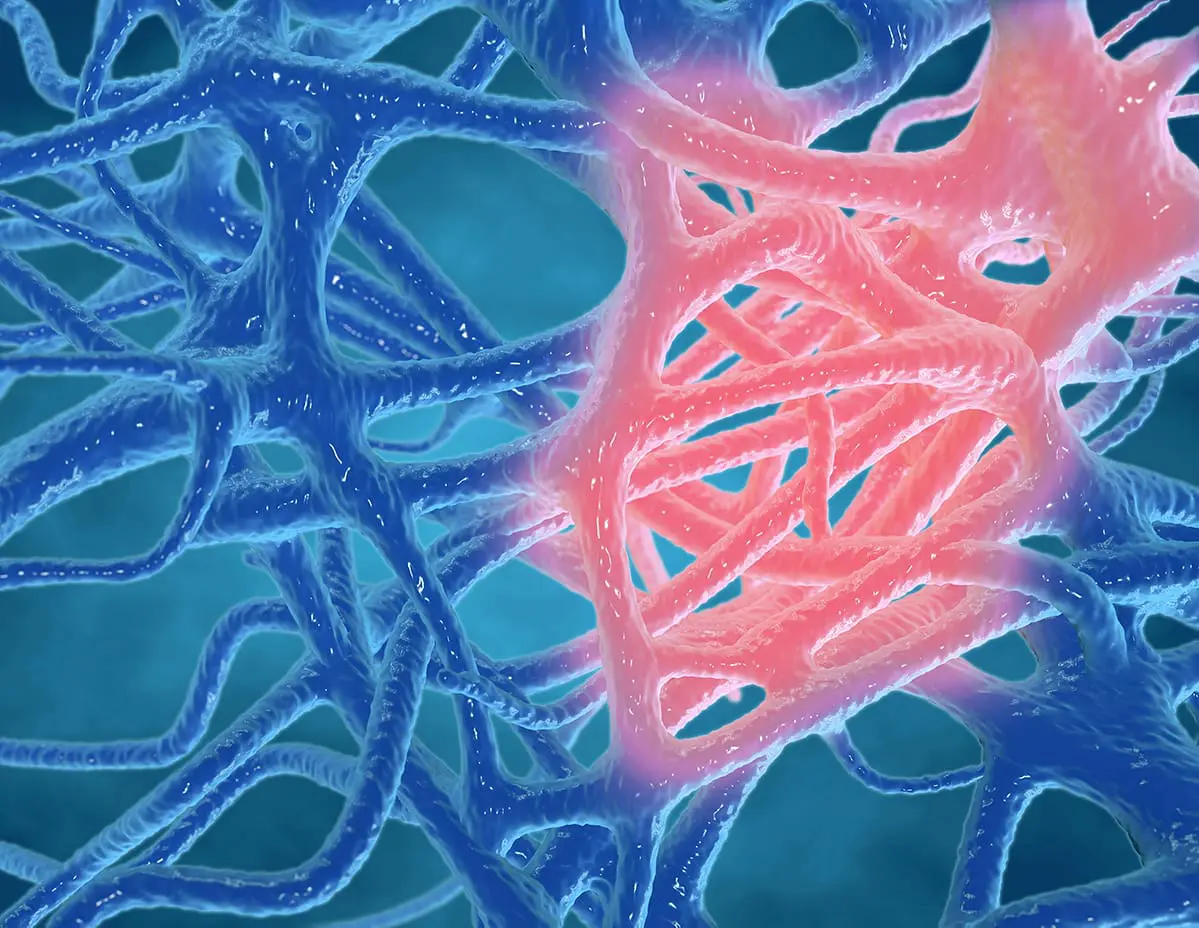 Low-level laser therapy acts differently on mRNA expression of anti- and pro-inflammatory mediators in collagenase-induced tendinitis in rat